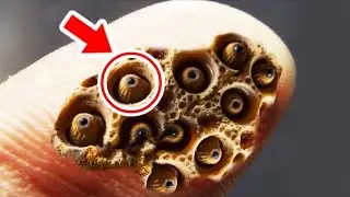 Weird Circle Appears on His Finger&hellip; Doctors Take One Look and Dial 911