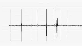 Single unit recording of the simple spike and complex spike activity of a Purkinje cell.