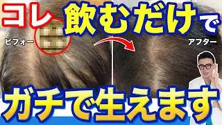 【女性の薄毛】ダイエットで髪が減る!? 内科医が教える新常識【スピロノラクトン】