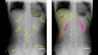 Radiological Anatomy of Abdomen & Pelvis