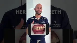 I&rsquo;m an adult. Can I fix my overbite with jaw surgery?
