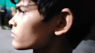 How I Fix My Overbite/Deepbite Naturally [NO BS]