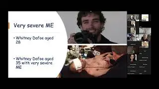 Clinical trial design in people with ME/CFS