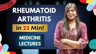 Rheumatoid arthritis - Diagnostic criteria, complications, treatment | Medicine notes and lectures