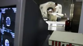 Study: Childhood CT scans linked to cancer