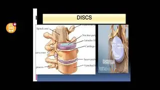 Spine Disorders by Vd Swapnil Navle