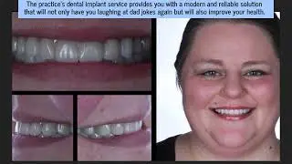 Top Plano Dentist Offers Advanced Implants As Long-Lasting Replacement Of Missing Teeth