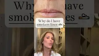 Why do I have Smokers&rsquo; Lines? #botox #beauty #filler