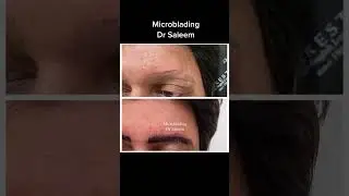 Microblading in lahore Pakistan