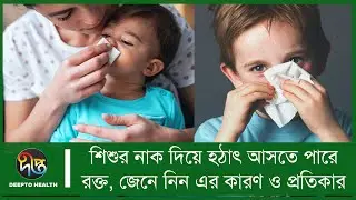 যে কোন শিশুর নাক দিয়ে হঠাৎ আসতে পারে রক্ত, জেনে নিন এর কারণ ও প্রতিকার | Health Tips