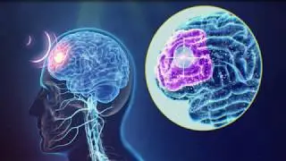 Transcranial Magnetic Stimulation