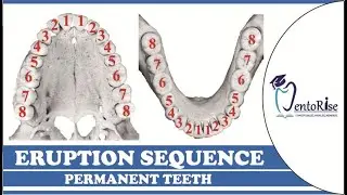 Eruption sequence of permanent teeth| Sequence of eruption of permanent teeth| Easy way to remember