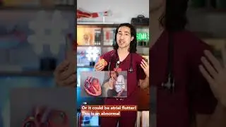 Трепетание сердца / Объясняет врач #доктор #трепетаниепредсердий #фиб