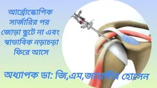 আর্থ্রোস্কোপি সার্জারির পর কাঁধের জোড়া ছুটে না এবং স্বাভাবিক নড়াচড়া ফিরে আসে। 