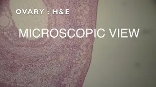 MICROSCOPIC VIEW - OVARY