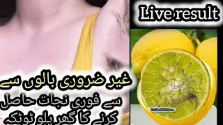 Permanent hair removal at home | Best Hair Removal Cream | Painless hair removal | DIY Remedies