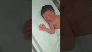 Day-40 baby treatment🩺😷.!#aiims#nicu#hospital#medicallife#newbornbaby#cutebaby#treatment#shortsfeed