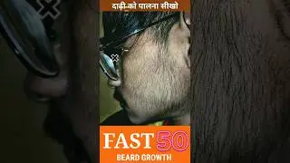 Beard growth 👉 Fast grow your facial hair || Beard results before and after #wantbeard #shorts