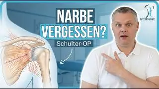 Schmerzen trotz Schulter-OP &ndash; der vergessene Faktor