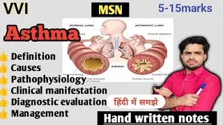 Asthma, bronchial asthma in Hindi | Defi, types pathophysiology, causes, symptoms, D/e , management