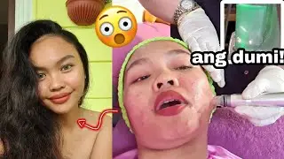 Part 6: I tried HydraFacial by Pretty calm, Ano ba ito?