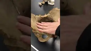 Pelvic Girdle FalseVsTruePelvis