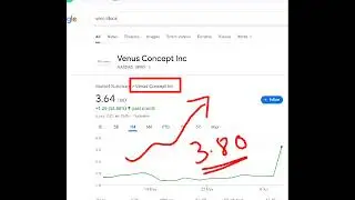 Venus Concept, vero stock analysis buy or sell it