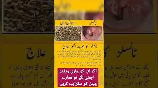 Health Tips#shorts #healthtips #urduhealthtips
