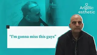 We asked Mr. Rashid about his hair transplant journey with Angelic esthetic and here is what he said