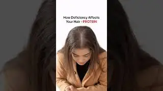 Fix this - Save your Hair!🚨 #hairfall #deficiency #omega3 #iron #hair #deficiency #protein #hairfall
