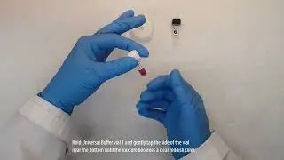 G4 HIV 1/2 - POC