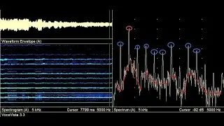 The Four Pillars of Singing - Spectrum Software To Help You Sing Better!