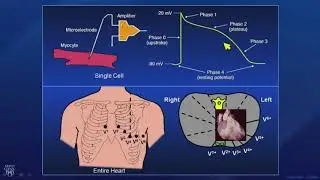 CME Preview: Current Applications and Future of Artificial Intelligence in Cardiology 2019