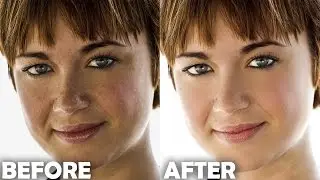 Photoshop Tutorial: How to Quickly Smooth Skin and Remove Blemishes & Scars | Part I
