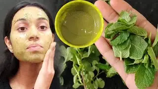 Mint Face Pack for Pimple Free, Acne Scars, Pigmentation & Refreshing Skin