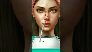 #asmr removal pimple and blackheads #asmr #facialanimation  #shorts