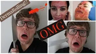 DERMAROLLING FOR VIRGINS  | Part One | AdamAshman