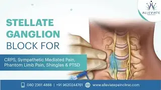 Stellate Ganglion Block for #chronicpain  #shingles #ptsd #breastcancersurvivors #arrhythmia #angina
