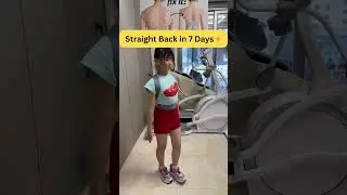 Fix Hunchback in 1 Hour a Day✅