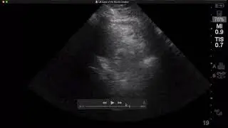 Brown Ultrasoud case of the month October