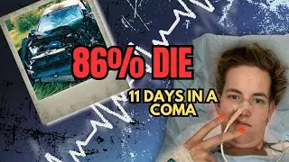 86% Don&rsquo;t Make It Within 24 Hours | A Coma Survivor Story