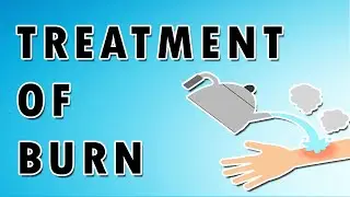 From Pain to Recovery: Effective Strategies for Treating Burns