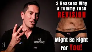 3 Reasons You May Need A Tummy Tuck Revision