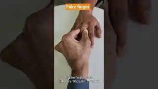 You won&rsquo;t believe this finger is NOT real! 😲 Fake finger #prosthetics #shortsfeed