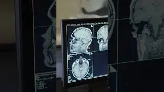 Born Different? Cambridge Scientists Reveal Brain Sex Differences at Birth!