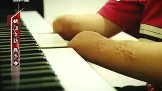 2011-05-28-民視異言堂-1-截肢女孩 舞青春 .avi