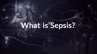 What is Sepsis? (Life-threatening Infection)