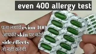 Evion 400 || vitamin E capsule || side effects of Evion 400 || allergy test at home