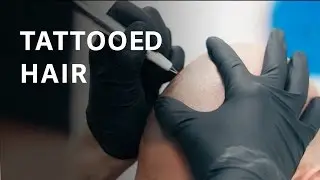 This &ldquo;hair tattoo&rdquo; is one cure for baldness