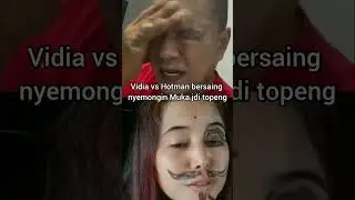 Vidia vs Hotman berong muka